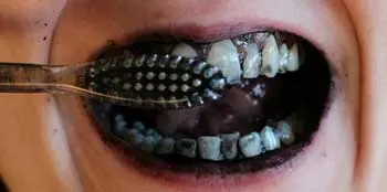 3. Coconut Charcoal Teeth Whitener